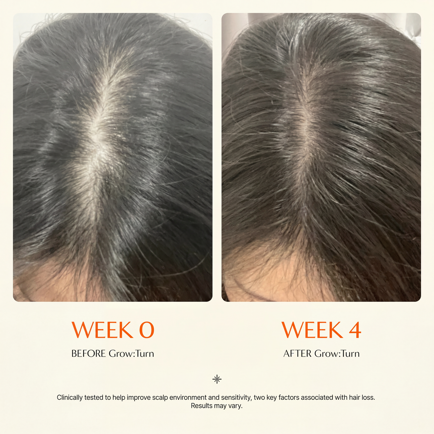 Grow Fuller Hair by Starting Where It Actually Grows