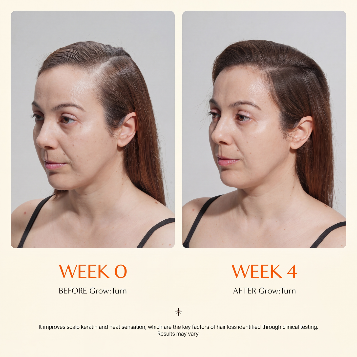Grow Fuller Hair by Starting Where It Actually Grows