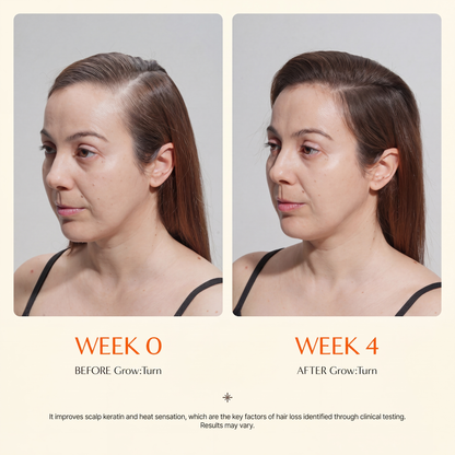Grow Fuller Hair by Starting Where It Actually Grows